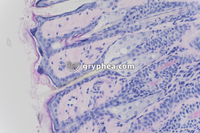 Peau avec glandes sébacées x100 - gryphea.com